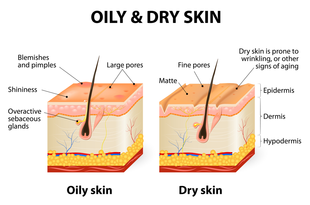 Oily-Skin-Do%E2%80%99s-and-Donts.jpg