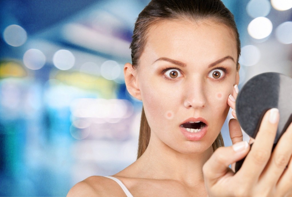 Large Pores and Acne: What’s the Connection? - ReliableRxPharmacy Blog ...