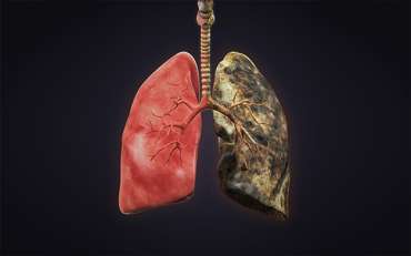 Smokers’ Lungs vs Healthy Lungs: Know the Difference ...