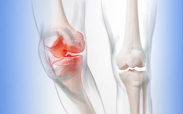 Avoid Five Things That Weaken The Bones ReliableRxPharmacy Blog 