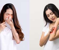 Allergies, its type and Treatment