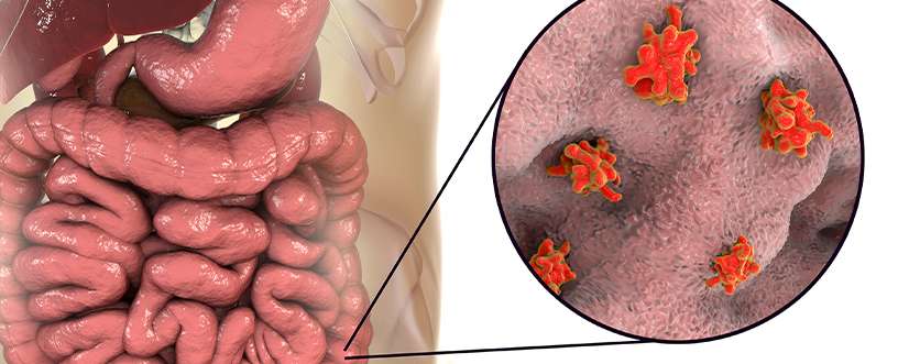 Top antiamoebic medications and treatments