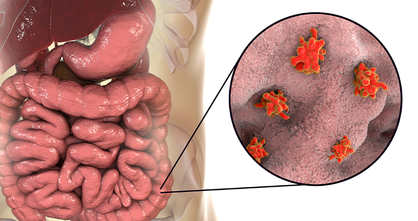 Top antiamoebic medications and treatments