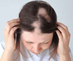 Effective alopecia treatments and regrowth solutions