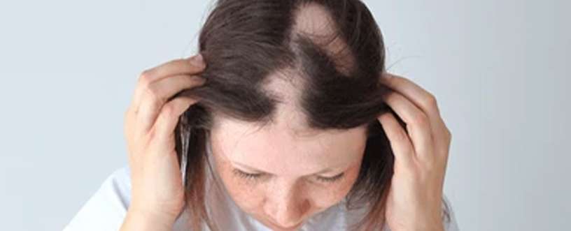 Effective alopecia treatments and regrowth solutions