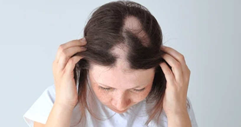 Effective alopecia treatments and regrowth solutions