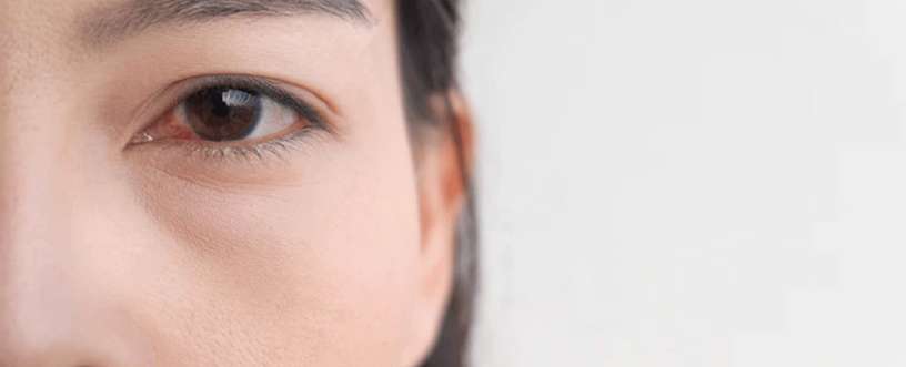 Relief for itchy, watery eyes caused by allergies