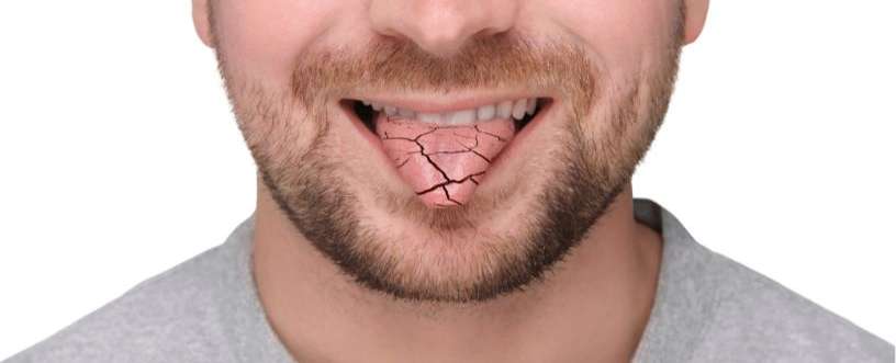 Pilomax 5 mg for Dry Mouth: Dosage and Precautions