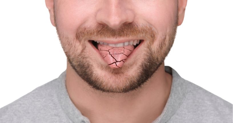 Pilomax 5 mg for Dry Mouth: Dosage and Precautions